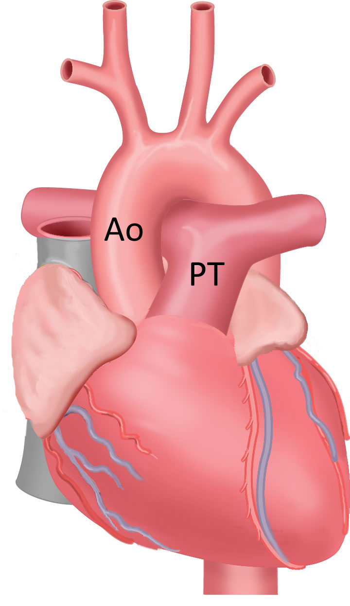 drawing-heart-with-coronaries-anatomytool